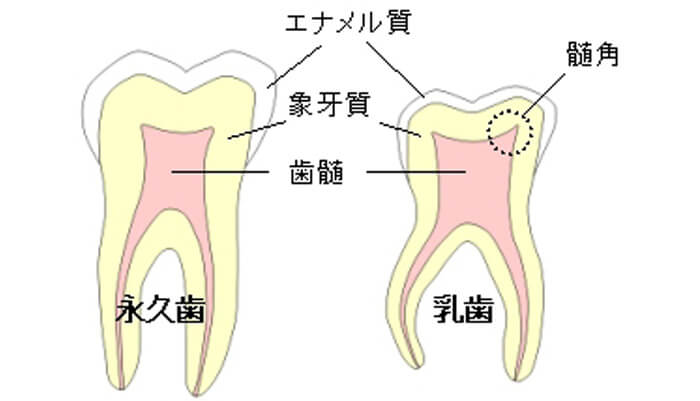 永久歯と乳歯の比較